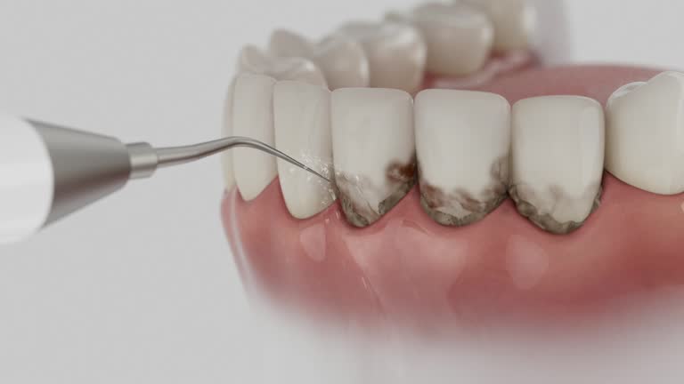 Trusted Tooth Extraction service in Tyrone, PA - Dentist Open Now